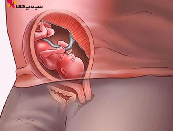 عکس جنین نوزده هفته پسر