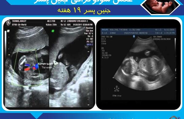 عکس جنین 19 هفته پسر