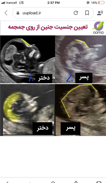 عکس جمجمه جنین پسر نی نی سایت