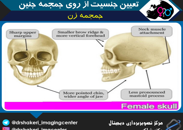 عکس جمجمه جنین پسر نی نی سایت