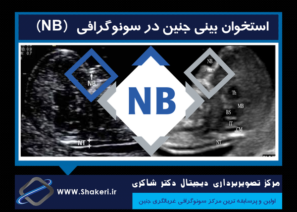 عکس جمجمه جنین پسر نی نی سایت