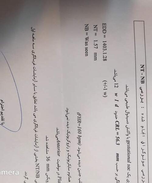 عکس جمجمه جنین پسر نی نی سایت