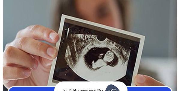 عکس جنین پسر و دختر در غربالگری اول
