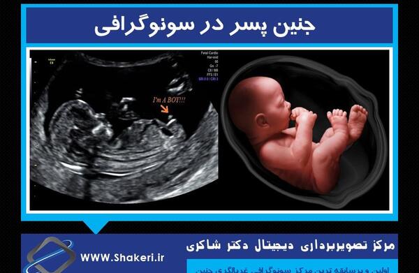 عکس جنین سه ماهه پسر در شکم مادر