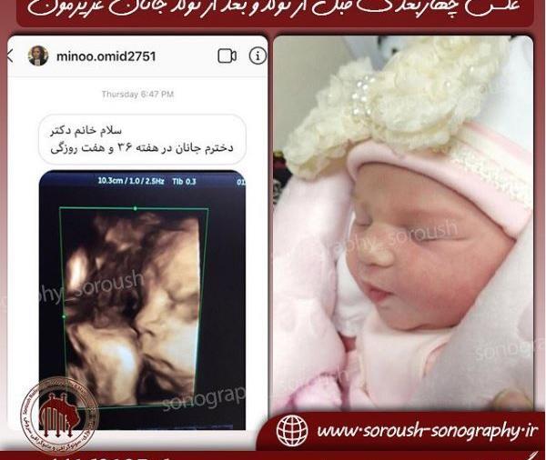 عکس جنین 6 ماهه پسر