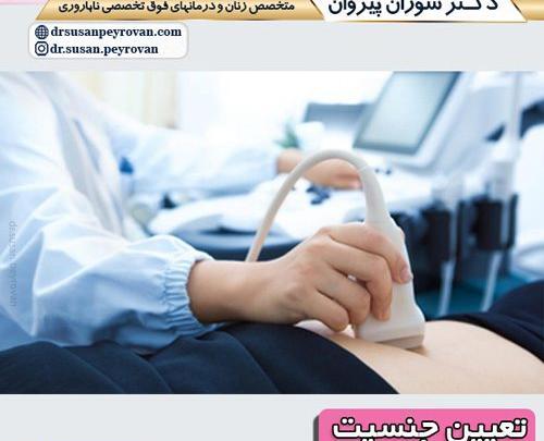 جنسیت عکس جنین 11 هفته پسر