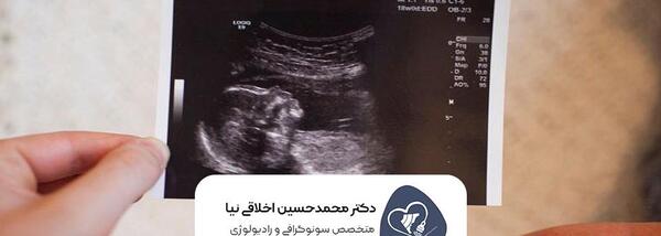 سونو nt عکس جنین 11 هفته پسر