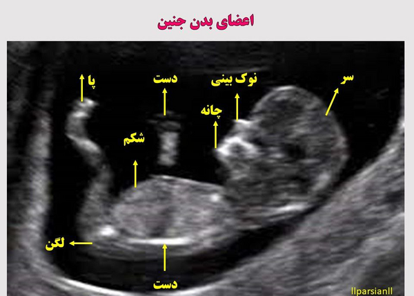 سونو nt عکس جنین 11 هفته پسر