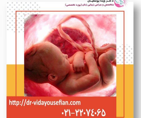 عکس جنین پسر در یازده هفته