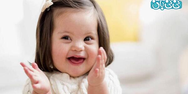 عکس گوش نوزاد سندروم داون