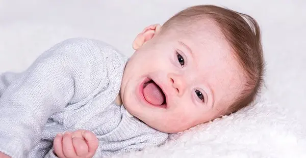 عکس گوش نوزاد سندروم داون