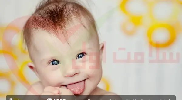 عکس زبان نوزاد سندروم داون