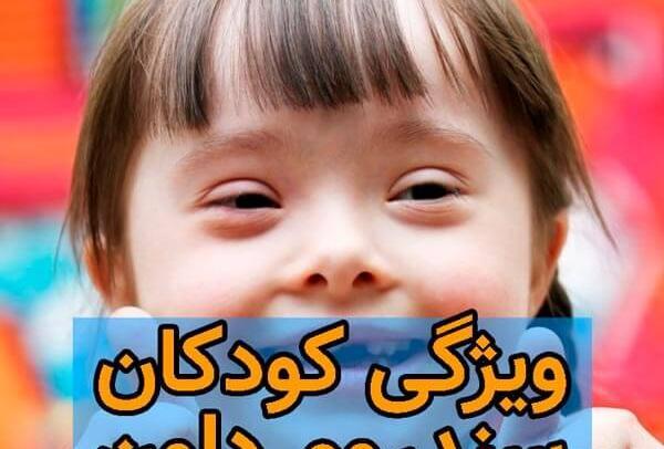 عکس زبان نوزاد سندروم داون