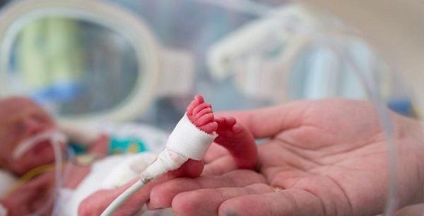 عکس نوزاد نارس 34 هفته
