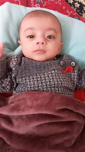 عکس نوزاد نارس 28 هفته