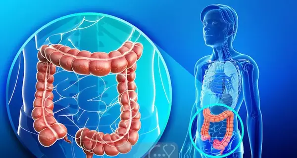عکس مدفوع خلطی نوزاد نی نی سایت