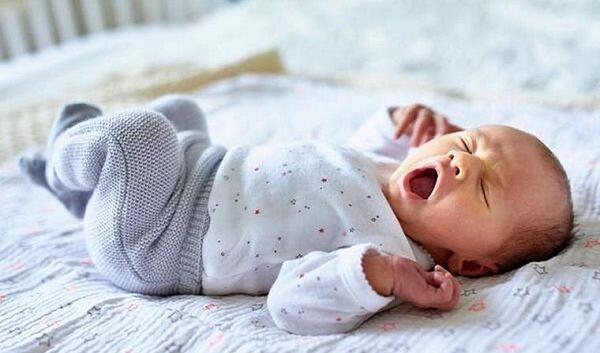 عکس نوزاد ناقص الخلقه