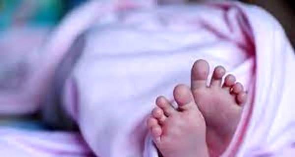 عکس نوزاد ناقص الخلقه