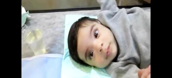 نوزاد عکس ختنه ناقص