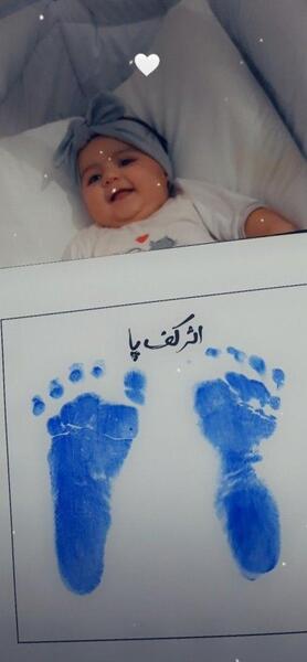 عکس کف پای نوزاد دختر
