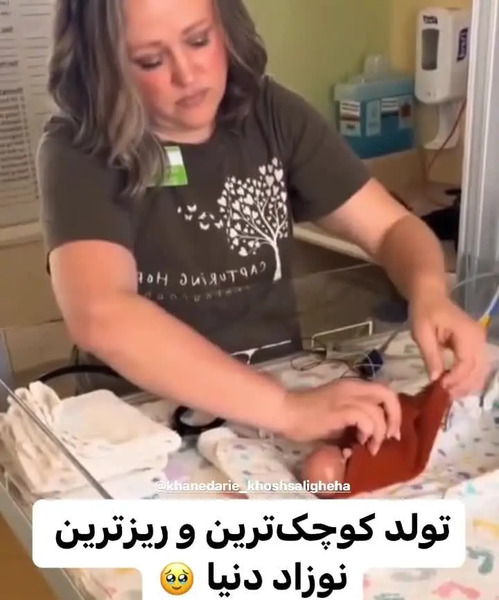 عکس کوچکترین نوزاد جهان