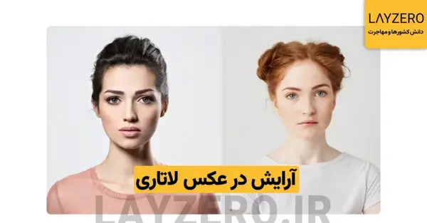 شرایط عکس لاتاری نوزاد