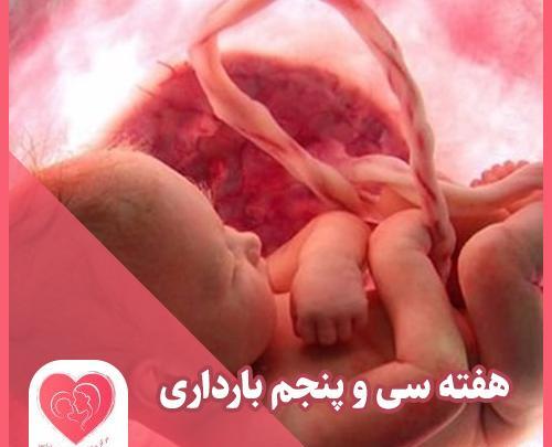 عکس نوزاد متولد شده در هفته 35