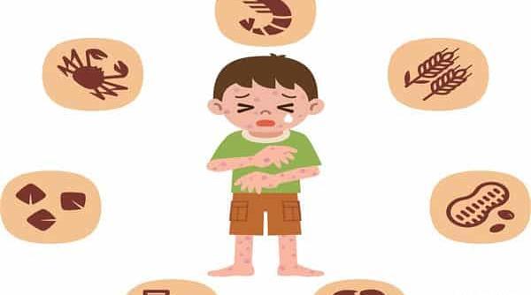 عکس حساسیت غذایی نوزاد