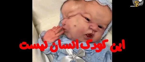عکس نوزاد های عجیب