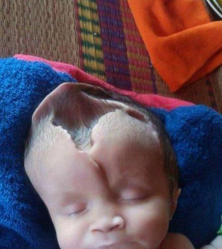 عکس نوزاد های عجیب