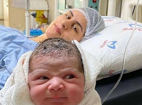 عکس نوزاد های عجیب