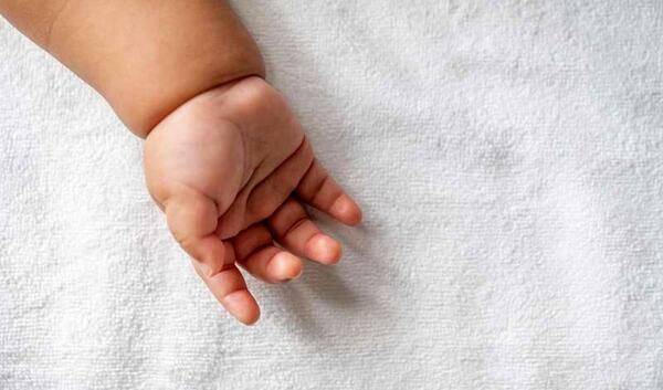 عکس نوزاد های عجیب
