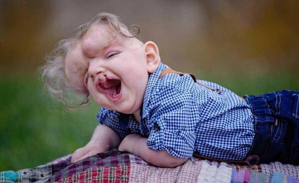 عکس نوزاد های عجیب