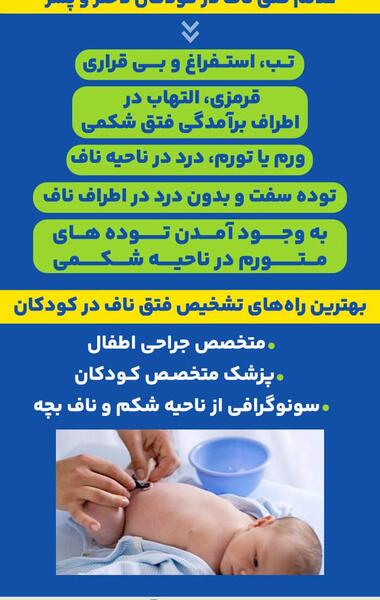 عکس ناف طبیعی نوزاد