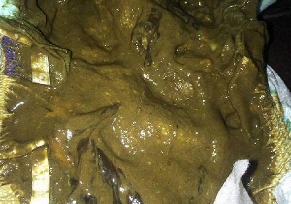 عکس مدفوع طبیعی نوزاد دوماهه