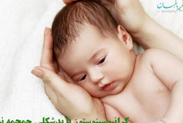 عکس شکل طبیعی سر نوزاد