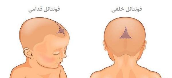 عکس شکل طبیعی سر نوزاد