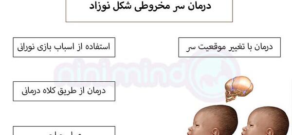 عکس شکل طبیعی سر نوزاد