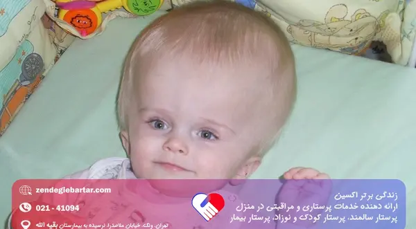 عکس شکل طبیعی سر نوزاد