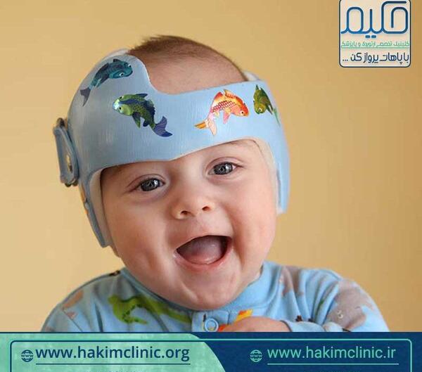 عکس شکل طبیعی سر نوزاد