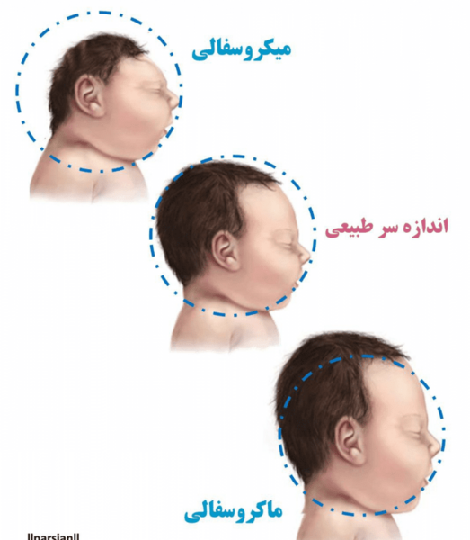 عکس شکل طبیعی سر نوزاد