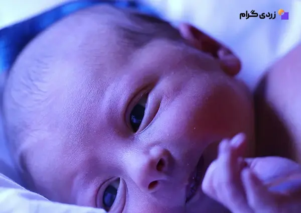 عکس مدفوع نوزاد طبیعی