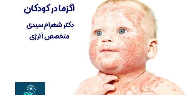 عکس اگزما صورت نوزاد