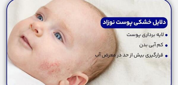 عکس اگزما صورت نوزاد