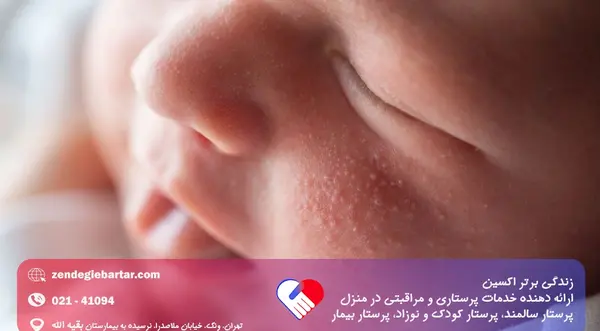 عکس گرمی صورت نوزاد