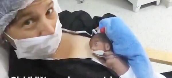 عکس نوزاد نارس شش ماهه