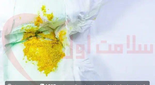 عکس اسهال نوزاد دو ماهه
