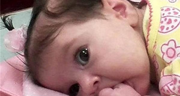 عکس اسهال نوزاد دو ماهه