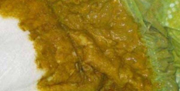 عکس مدفوع نوزاد دو ماهه