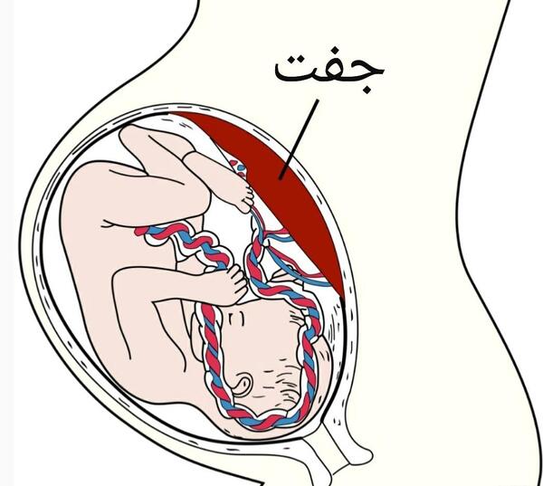 عکس نوزاد در داخل شکم مادر